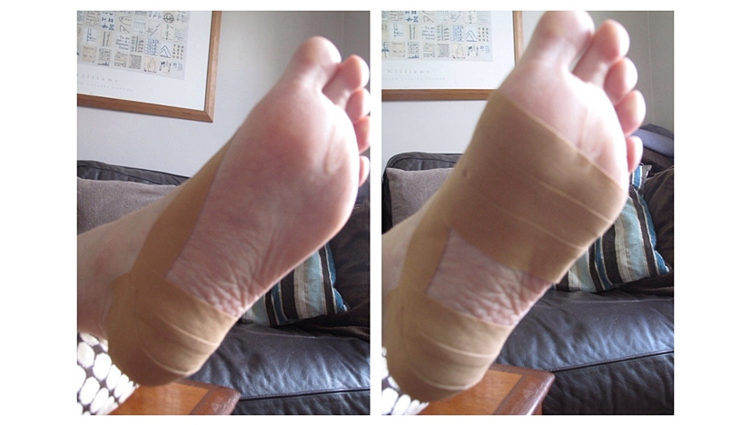 Leukotape on a foot